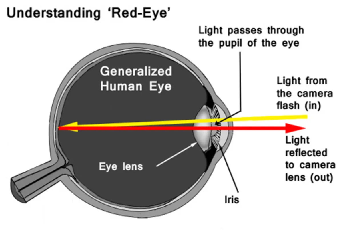 What is a red eye diagram | Skylum Blog